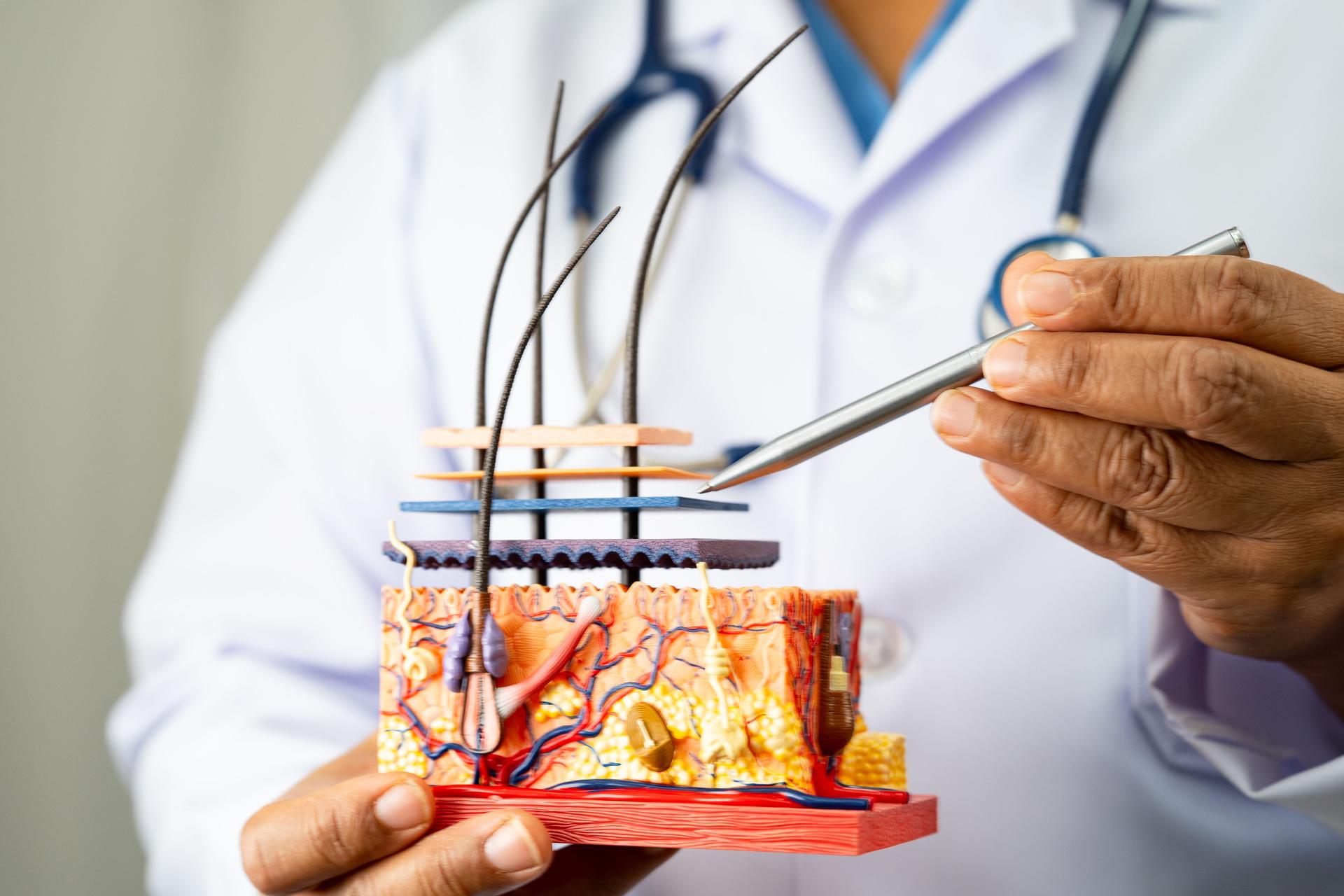 Asian dermatologist doctor holding skin structure model anatomy for treatment in hospital, hair transplant.