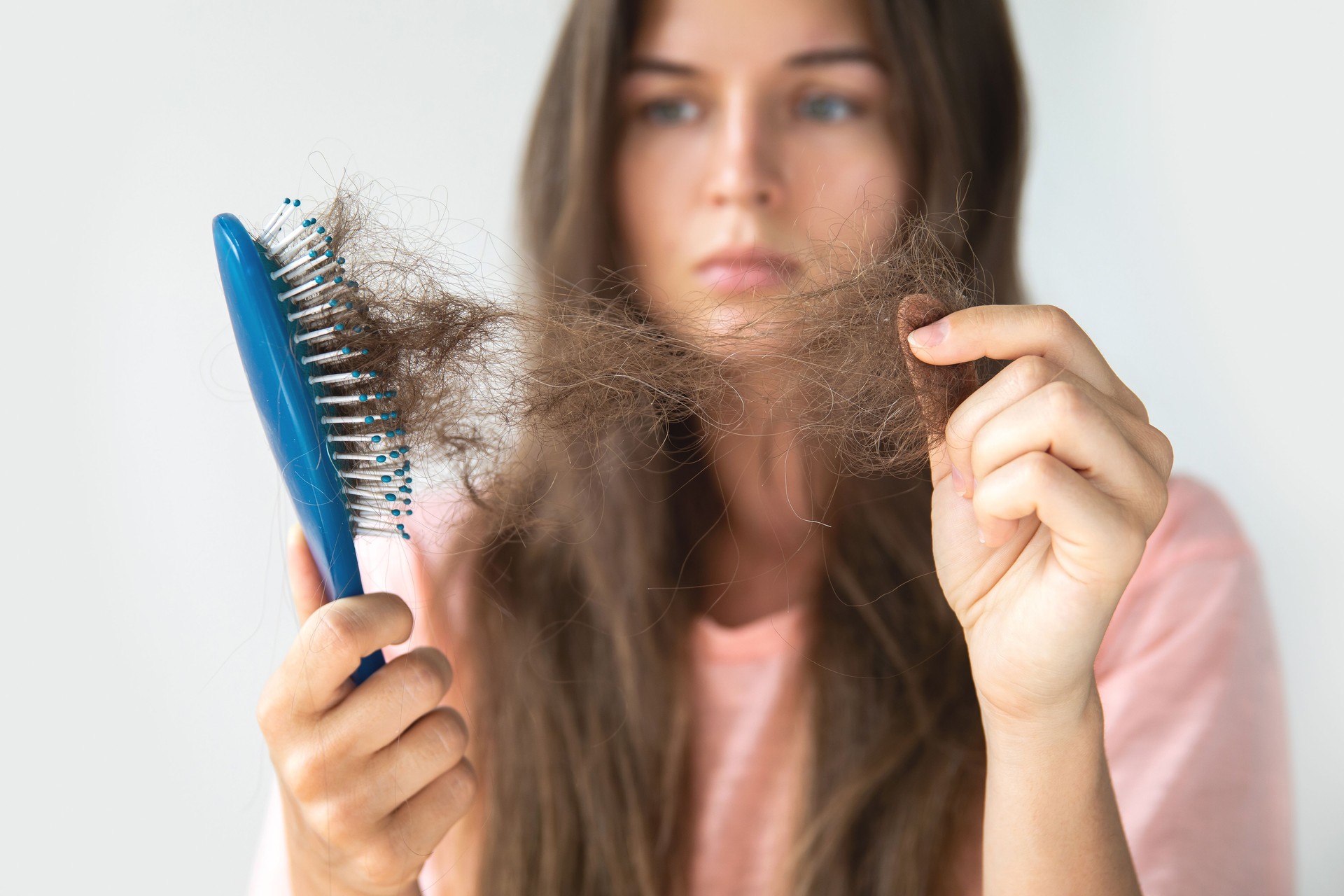 Young woman is upset because of hair loss